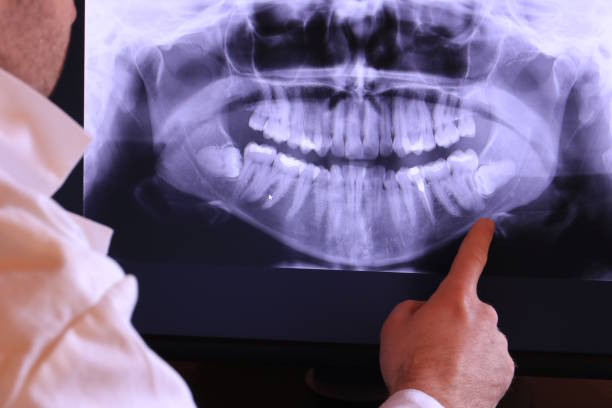Best Emergency Tooth Extraction in Bridgeport, MI
