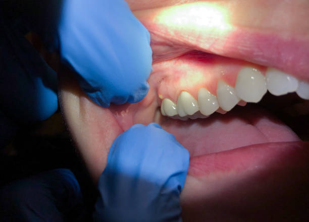Best Emergency Orthodontic Repairs in Bridgeport, MI